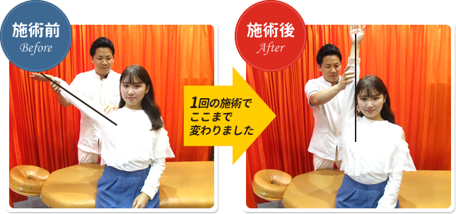 1回の施術でここまで変わりました